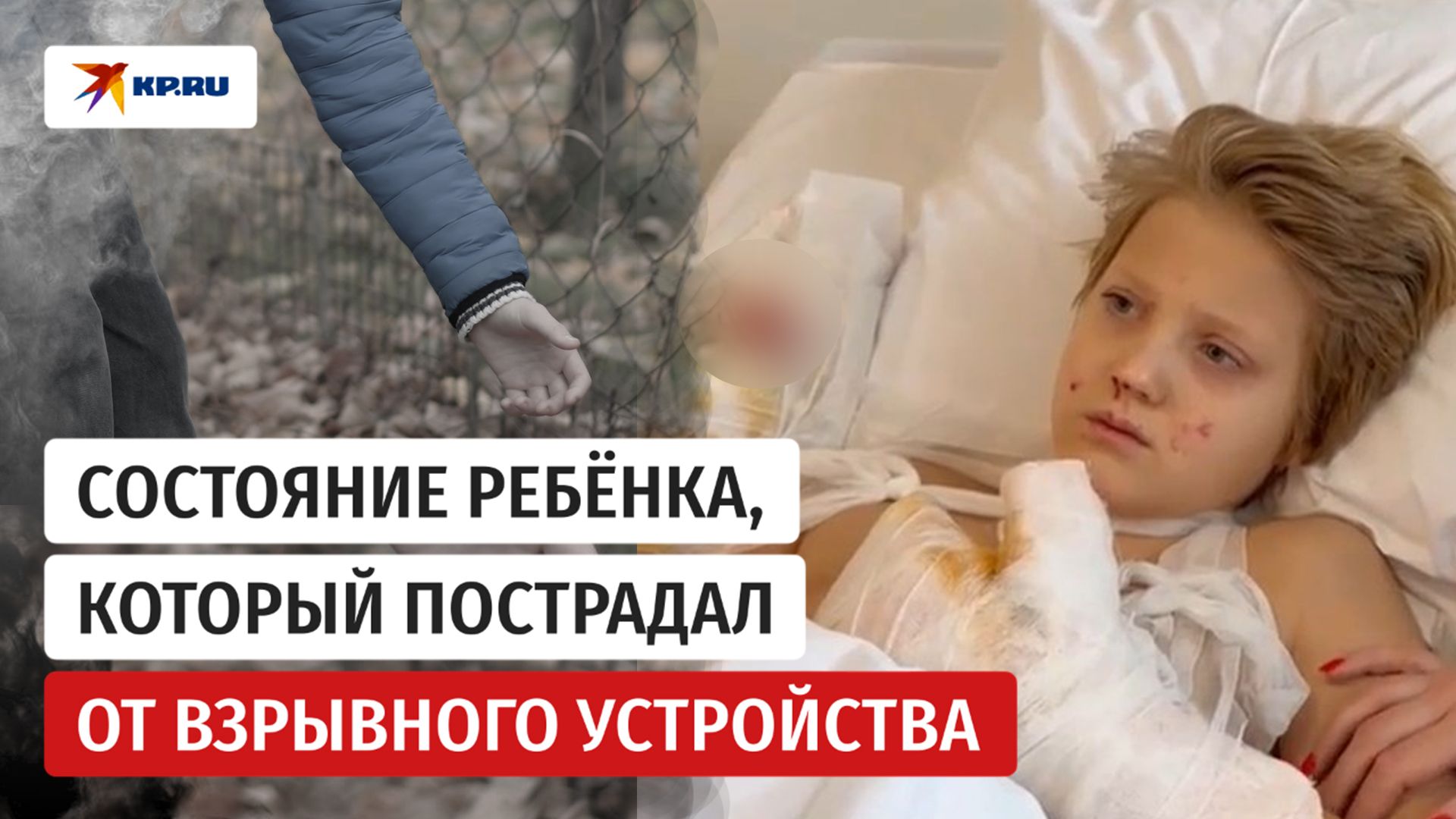 «Не удалось сохранить 4 пальца»: что стало с ребёнком, который подобрал взрывное устройство смотреть онлайн