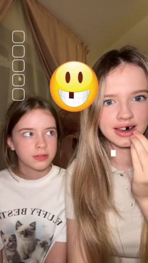 осталась без зуба #суперсофи #supersofi #зуб #зубы