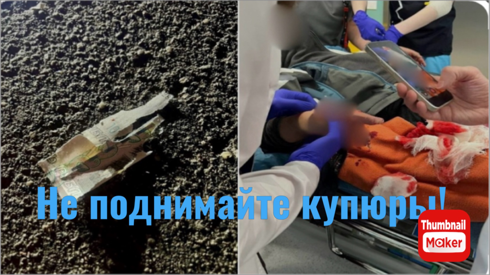 10 летний мальчик поднял купюру и ему оторвало пальцы смотреть онлайн