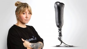 Подготовка к протезированию. Важные аспекты. Прямой эфир с реабилитологом