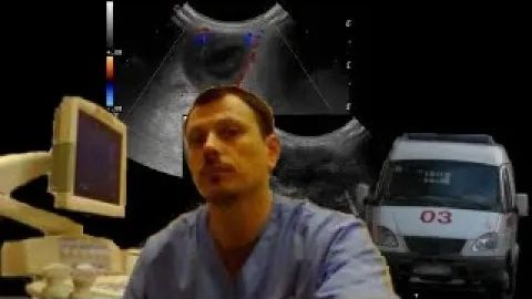 Детское УЗИ мягких тканей - Киста копчика смотреть онлайн