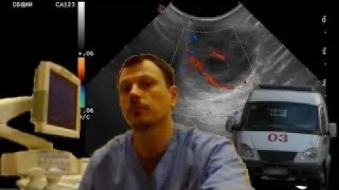 Детское УЗИ мягких тканей - Парапроктит смотреть онлайн