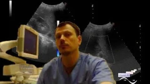 Детское УЗИ почек - Образование надпочечника смотреть онлайн