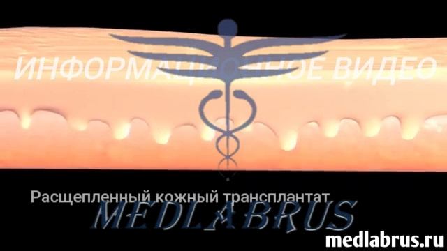 Пересадка кожи: восстановление поврежденной кожи