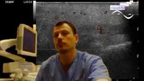 Детское УЗИ мягких тканей - Отек щеки смотреть онлайн