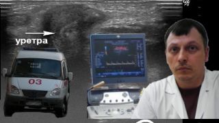 Детское УЗИ мягких тканей - Катетер в уретре смотреть онлайн