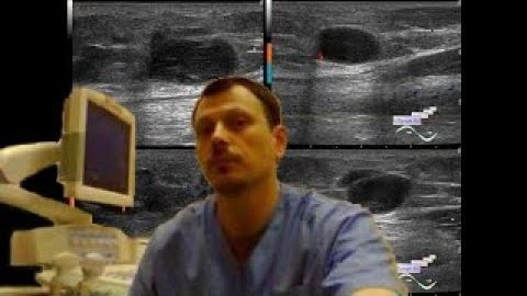 Детское УЗИ мягких тканей - Образования бедра смотреть онлайн