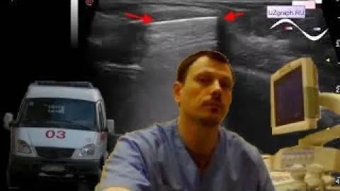 Детское УЗИ костей - Грудная пластина смотреть онлайн