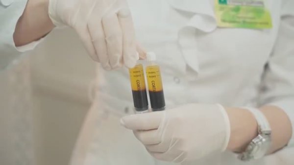 Плазмотерапия Cortexil PRP