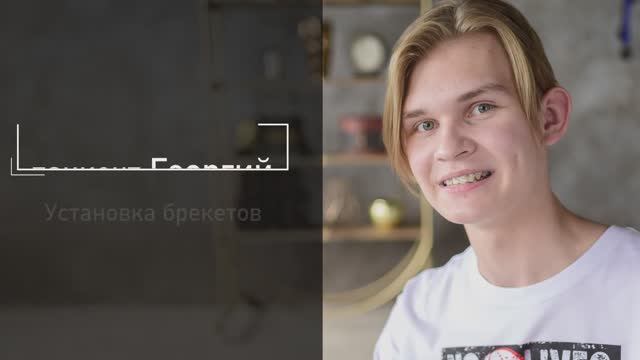 Удаление резца и исправление прикуса на брекет-системе. Видеоотзыв пациента NKclinic