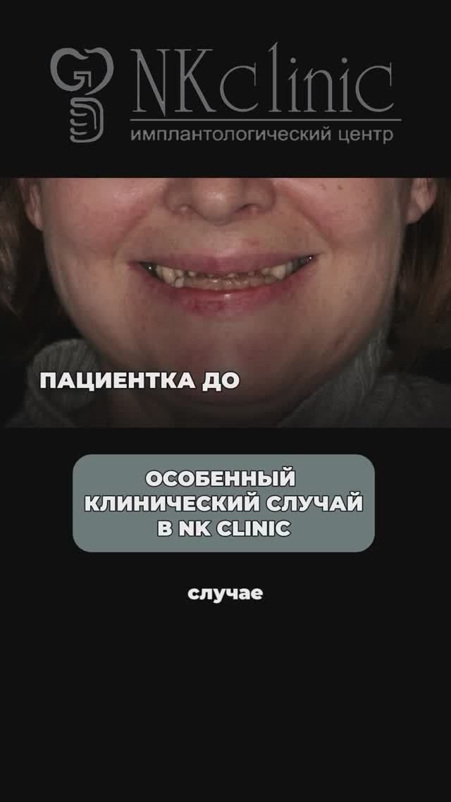 Не открывался рот. Главный врач NKclinic про сложный клинический случай