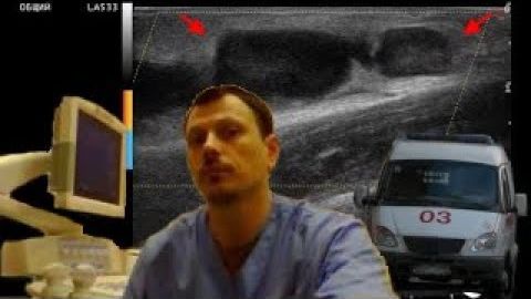 Детское УЗИ мягких тканей - Деструкция бедренных лимфатических узлов смотреть онлайн