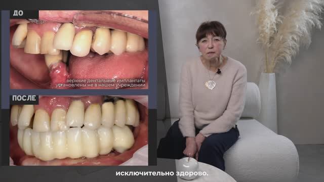 NKclinic - отзывы пациентов. Удалили опухоль слюнной железы и восстановили челюсть за одну операцию