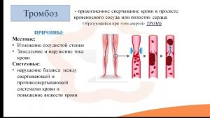 Видео-лекция №25.2. Стаз, тромбоз и эмболия