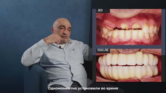 NKclinic - отзывы пациентов. Удалили опухоль и восстановили челюсть. Жизнь после амелобластомы