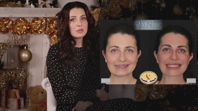 NKclinic - отзывы пациентов. «После операции это здорово, когда ты начинаешь правильно жевать».