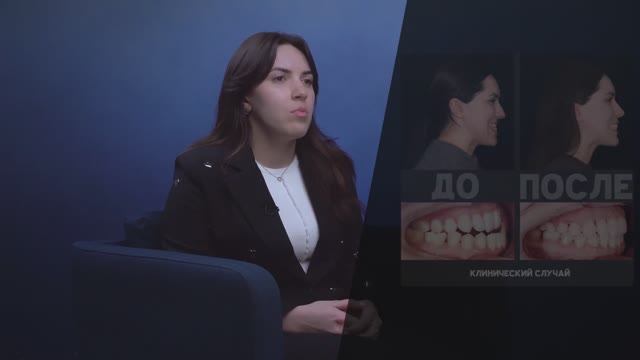 NKclinic - отзывы пациентов. С 10 лет хотела исправить нижнюю челюсть - помогли за одну операцию