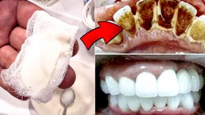 Секрет ИДЕАЛЬНОЙ Улыбки! Избавьтесь от Желтого НАЛЕТА за 2 Минуты!