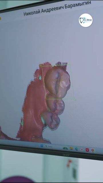 Коронки на передние зубы от клиники "Эл Дент". г. Якутск, ул. Кальвица 30 смотреть онлайн