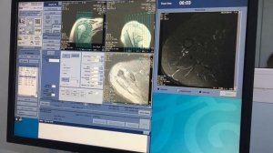 МРТ плечевого сустава: пошаговое руководство для лаборанта