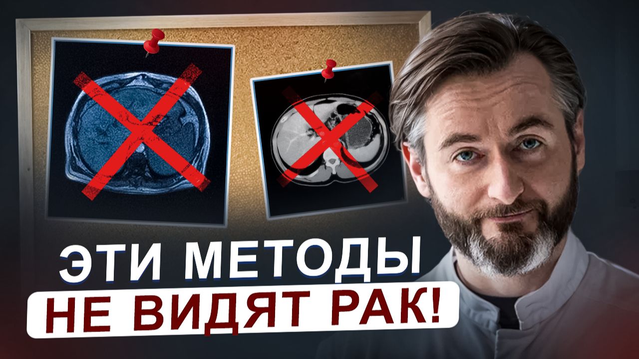КТ, МРТ и ПЭТ: Опасные заблуждения в диагностике рака желудка