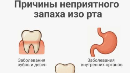 Как устранить плохой запах изо рта смотреть онлайн