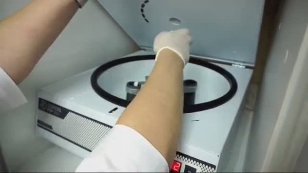 Плазмотерапия Cortexil PRP