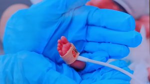 17 ноября международный день недоношенных детей