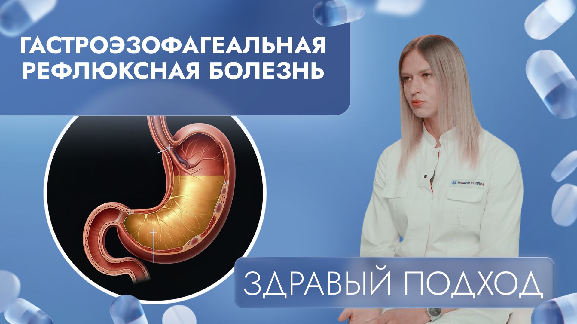 Почему ГЭРБ может привести к онкологии? | Здравый подход (2025)