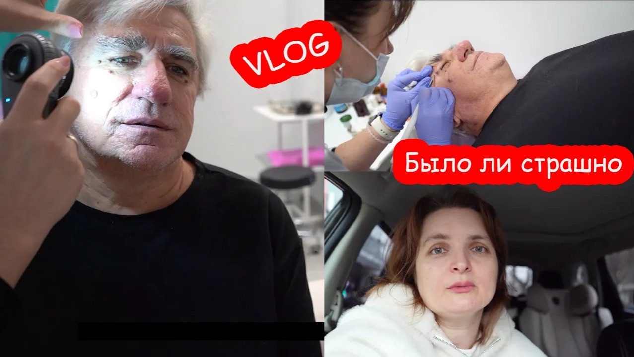 VLOG Удаляем родинки. Я не знала как это делается смотреть онлайн