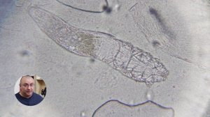 Клещ Демодекс под микроскопом: что сделает с ним микроволновка?!