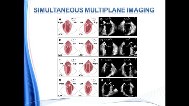 Guidelines For Performing A Comprehensive Transesophageal Echocardiographic Examination на русском
