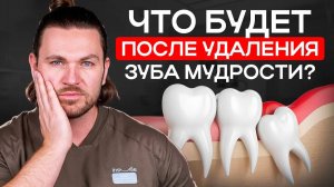 Удалили зуб мудрости? Вот чего ожидать дальше