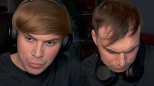 ГЛЕБ СДЕЛАЛ ПЕРЕСАДКУ ВОЛОС и ВЕРНУЛ СВОЙ ПРАЙМ | Sasavot