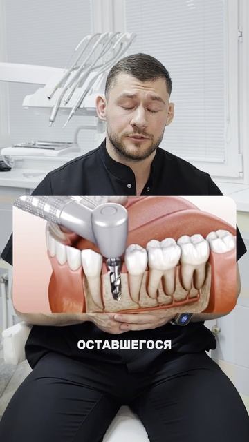 Остался фрагмент зуба после удаления: что делать? смотреть онлайн