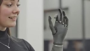 Протез руки