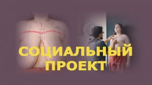 Доктор Мустафаев помог девушке с макромастией | Соцпроект «Такие дела»