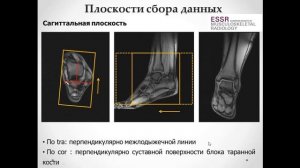 Базовый курс МРТ  «МР анатомия голеностопного сустава и методика сбора данных» Лектор Учеваткин А.А