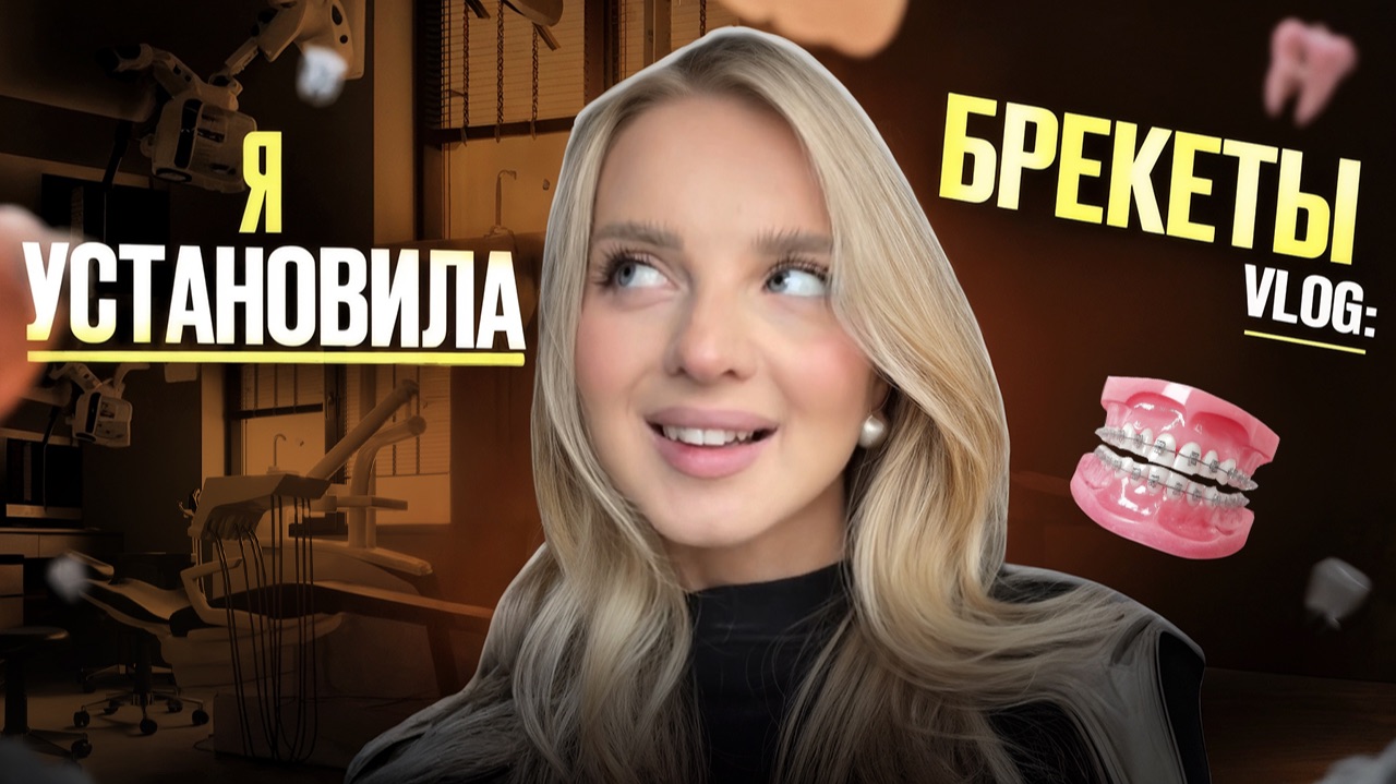 VLOG: установка брекетов | первые ощущения , что важно знать смотреть онлайн