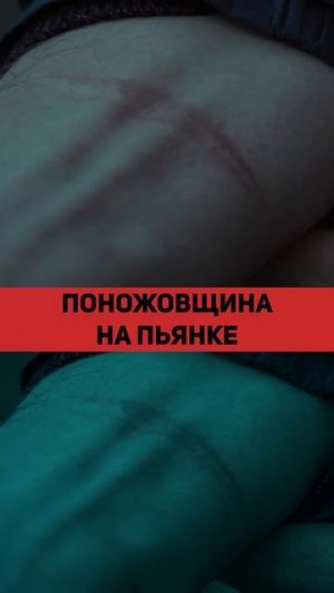 ПЬЯНКА ЗАКОНЧИЛАСЬ ЛУЖЕЙ КРОВИ #запой #трезвость #отходняк