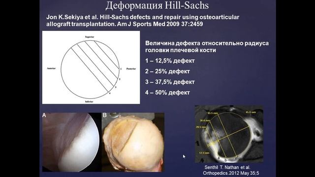 Базовый курс по МРТ  B  Лекция «МР семиотика повреждений плечевого сустава»  Лектор  Учеваткин А А