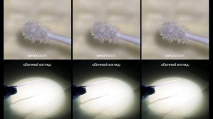 Почему мы используем микроскоп в лечении