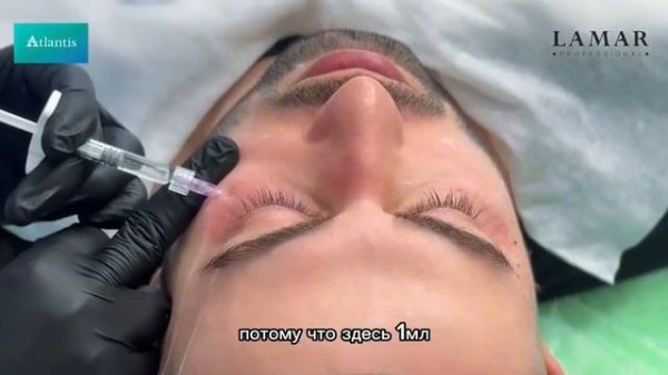 Сочетанный протокол процедуры Fresh Man