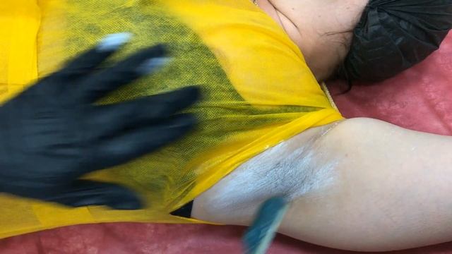 Депиляция подмышек горячим воском DolceVita