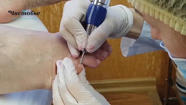 Аппаратный педикюр с косметикой MS Nails: мастер-класс от Ирины Набок