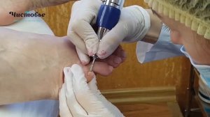 Аппаратный педикюр с косметикой MS Nails: мастер-класс от Ирины Набок