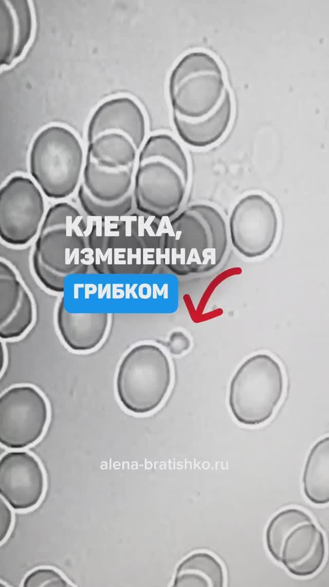 Клетка измененная грибком. Семейный доктор Алена Братишко смотреть онлайн
