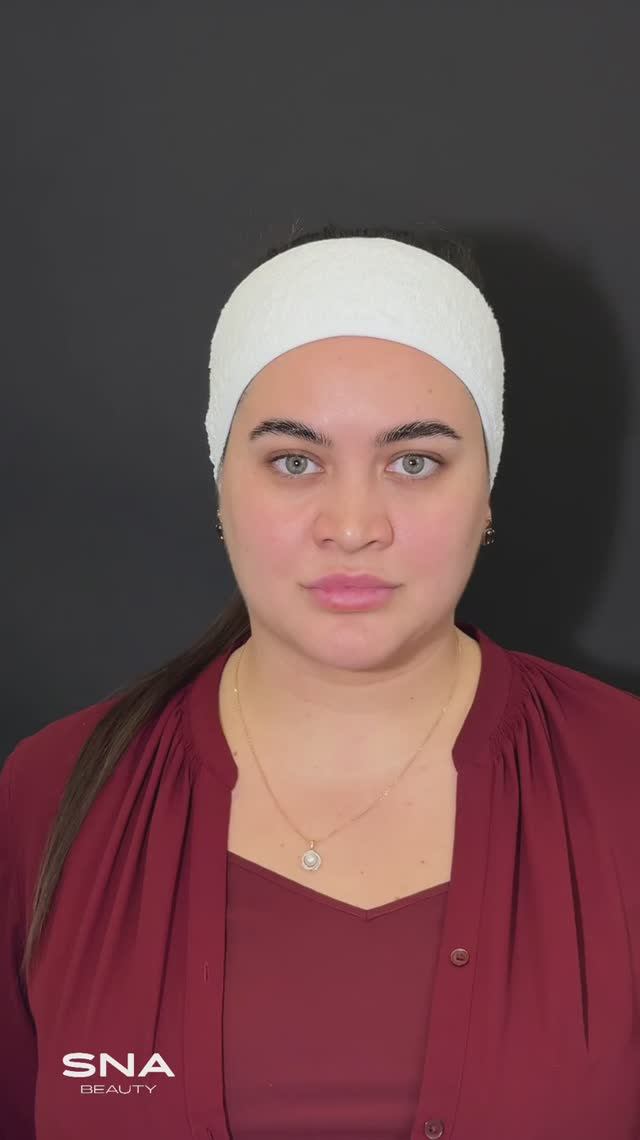 Контурная пластика скул и губ