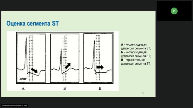 Вебинары Функциональная диагностика для СМП