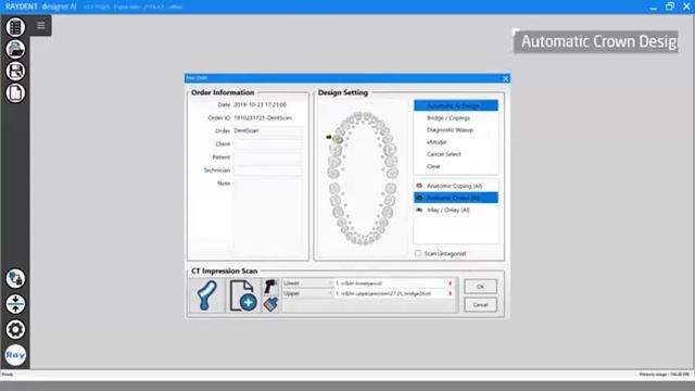 RAY CBCT Digital Workflow смотреть онлайн